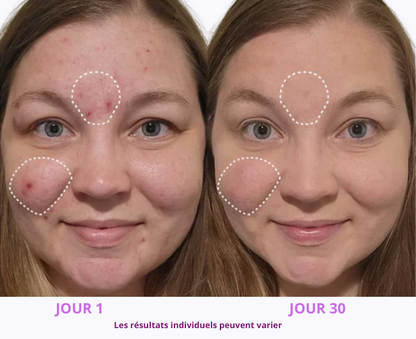 Masseur sculptant électrique Visage & Cou