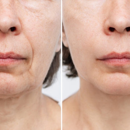 Masseur sculptant électrique Visage & Cou